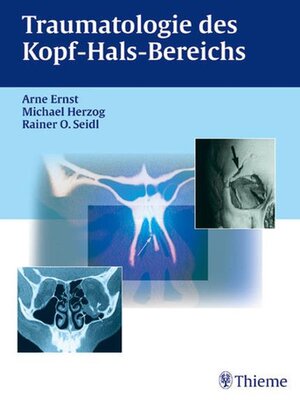 cover image of Traumatologie des Kopf-Hals-Bereichs